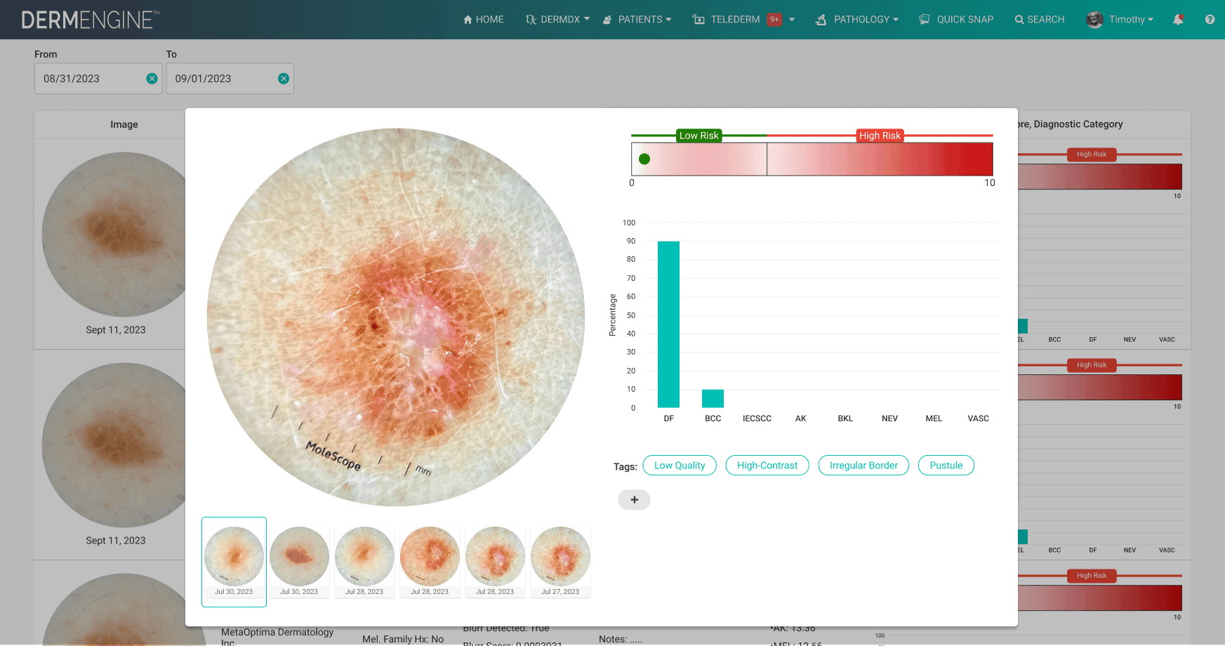 DermDx — software-only AI skin-cancer diagnosis, FDA-pending — hero image