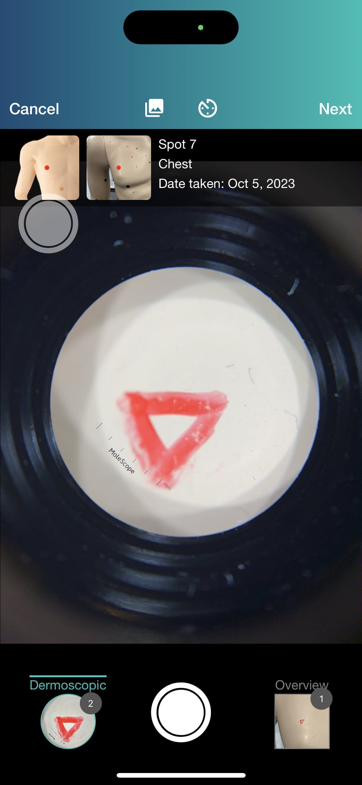 DermEngine camera — clinical imaging device