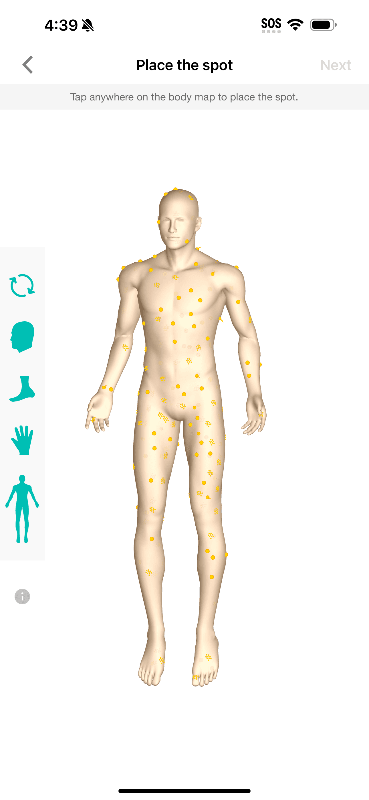 Body map — lesion overlay and change detection